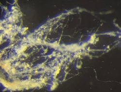 Scientists Have Just Discovered a New Type of Electricity-Conducting Bacteria